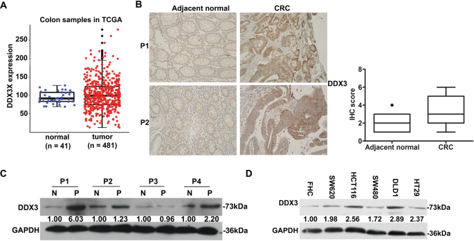 Fig. 4: The expression of DDX3 is upregulated in CRC samples.