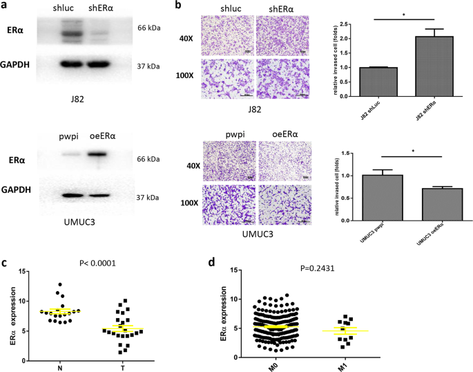 Fig. 1: ERα decreases BCa invasion.