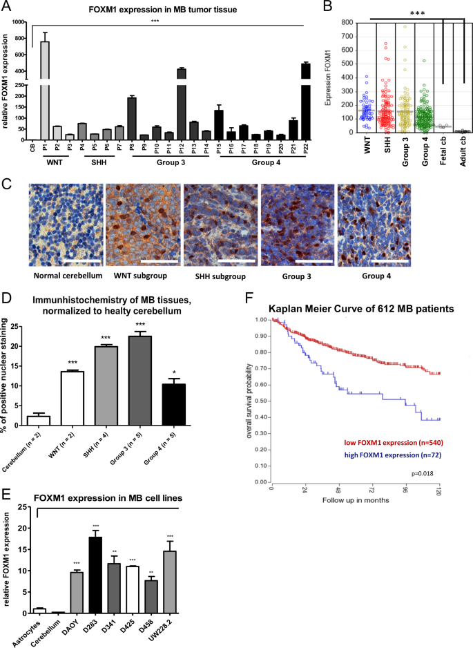 Fig. 2: mRNA expression levels of FOXM1 in MB tissue samples and MB cell lines.