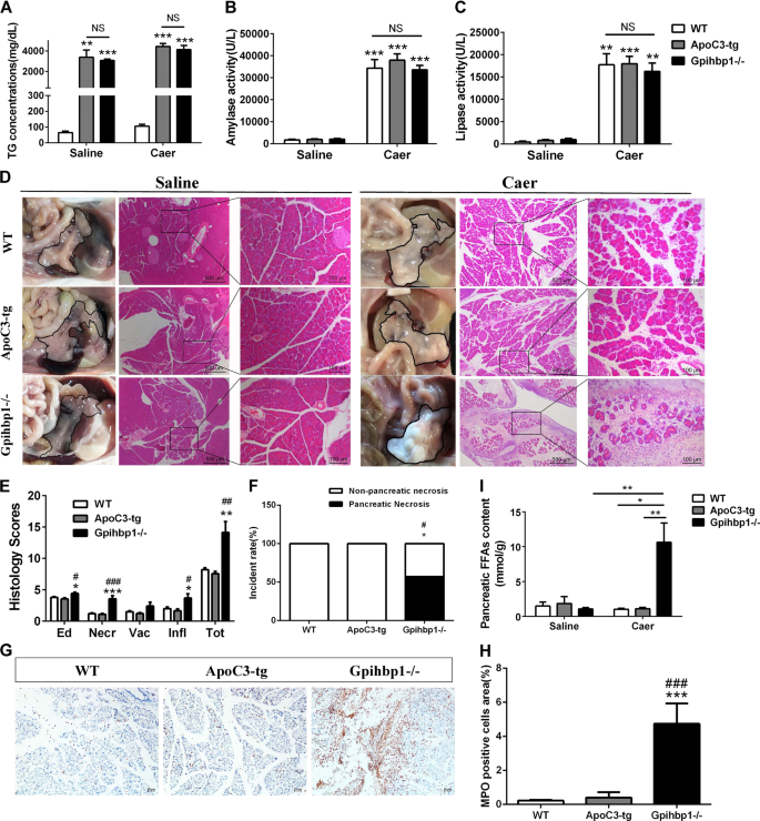 Fig. 2: The comparison of pancreatic injury, inflammation and free fatty acids of pancreas between wild-type, ApoC3-tg and Gpihbp1−/− mice in caerulein-induced acute pancreatitis.