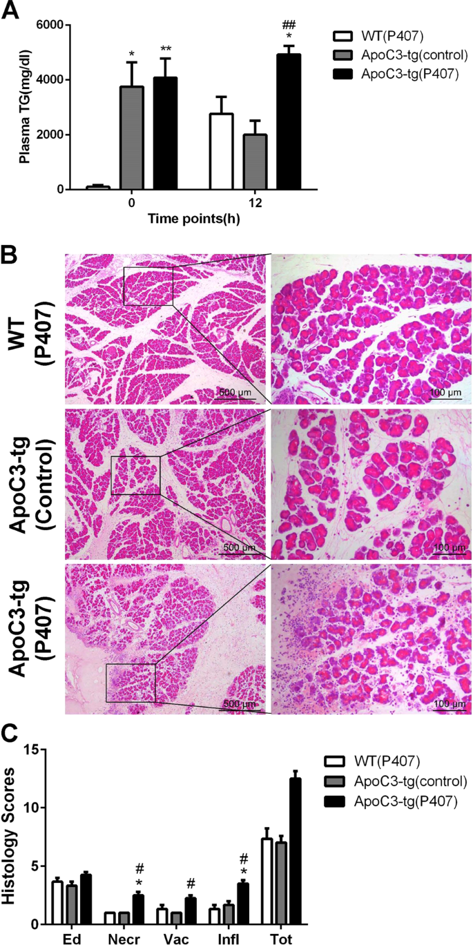 Fig. 3: The comparison of pancreatic injury between ApoC3-tg mice with and without the administration of Poloxamer 407.