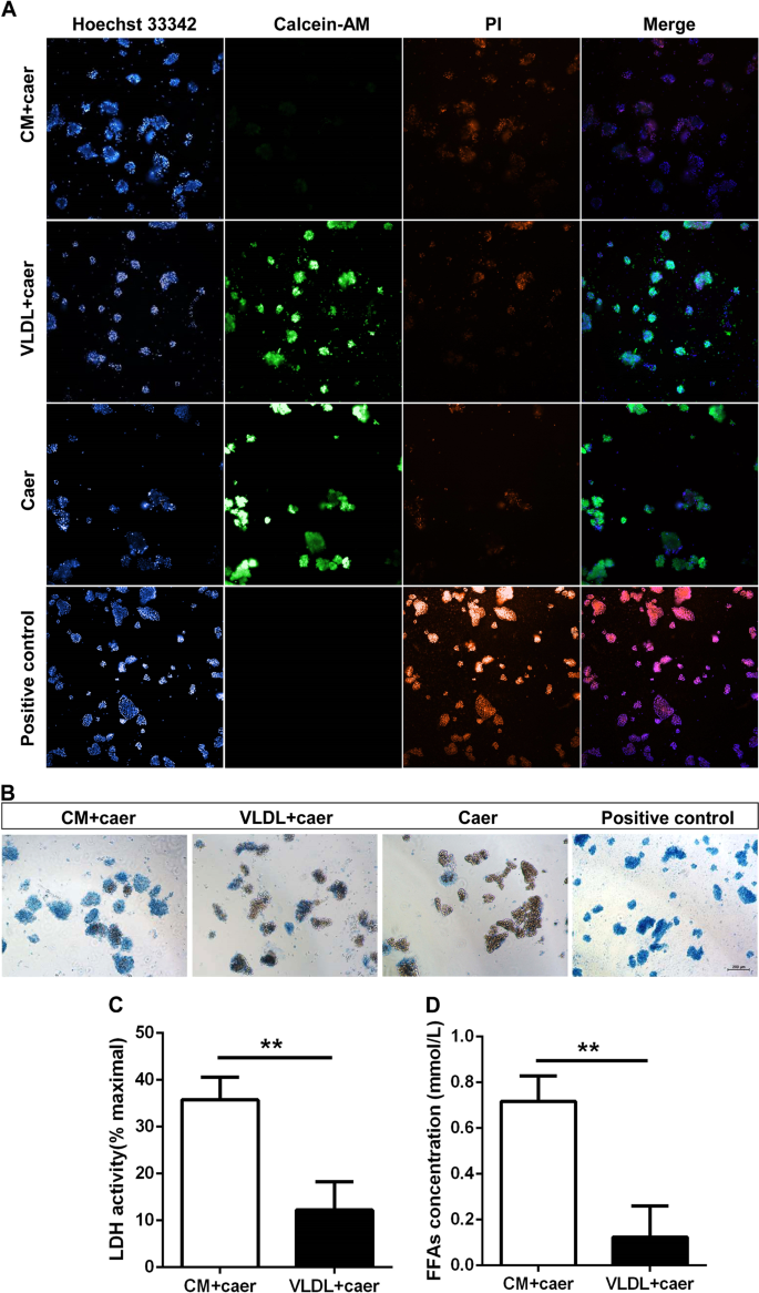 Fig. 5: The comparison of cytotoxicity to primary pancreatic acinar cells between chylomicron and very low-density lipoprotein from acute pancreatitis patients with hypertriglyceridemia.