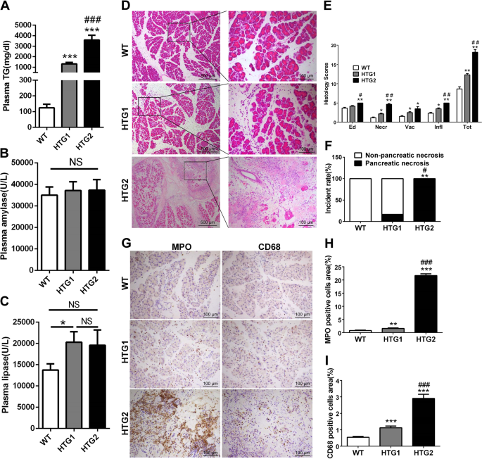 Fig. 6: The comparison of pancreatic injury and inflammation between Gpihbp1−/− mice with different HTG severity in caerulein-induced acute pancreatitis.