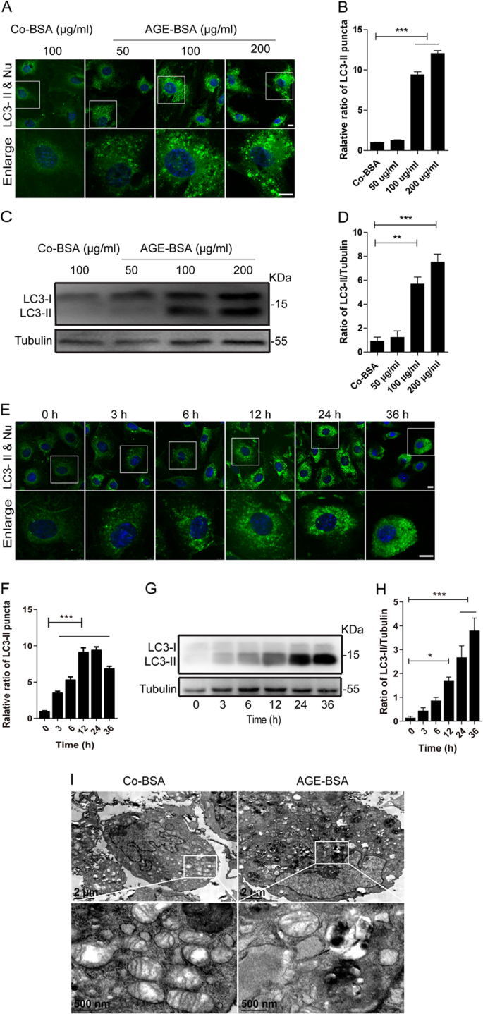 Lysosome Restoration To Activate Podocyte Autophagy A New Therapeutic Strategy For Diabetic Kidney Disease Cell Death Disease