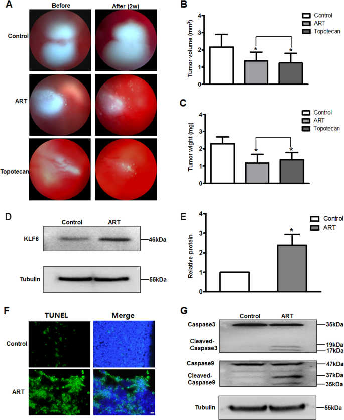 Fig. 5: ART induces RB tumor cells apoptosis and upregulates KLF6 in vivo.