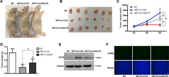 Fig. 6: KLF6 silencing attenuates the effect of ART on inhibiting tumor growth in vivo.