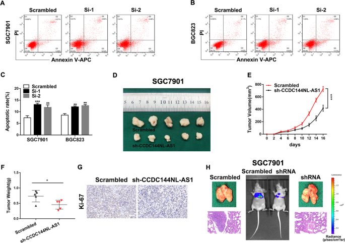 Fig. 3: Knockdown of CCDC144NL-AS1 induces cell apoptosis, inhibits GC tumor growth, and metastasis in vivo.
