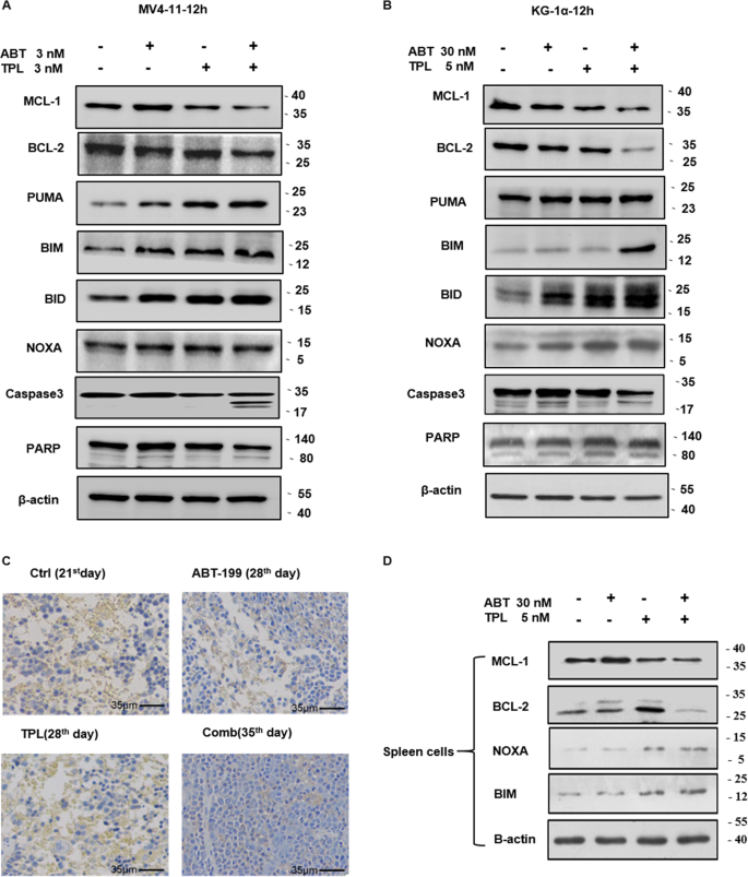 Fig. 5: Combination of TPL and ABT-199 reciprocally regulates Bcl-2 family proteins.