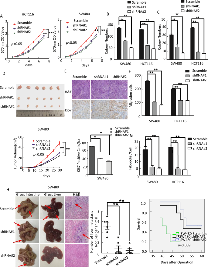 Fig. 3: Knocking down of OSBPL3 inhibits progression of CRC cells.