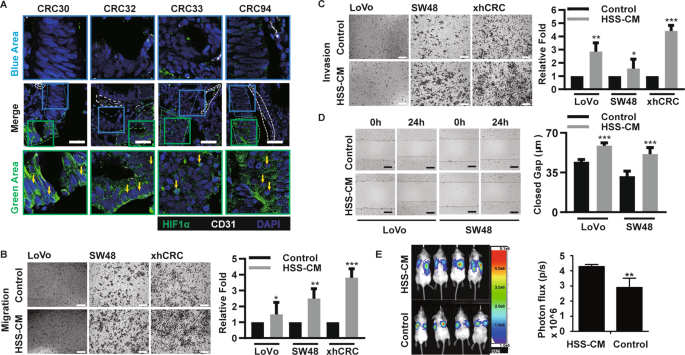 Fig. 2: Hypoxic CRC cells enhance the migration, invasion and metastatic capacity of normoxic CRC cells.