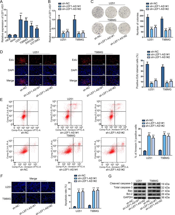Lef1 As1 Accelerates Tumorigenesis In Glioma By Sponging Mir 489 3p To Enhance Higd1a Cell Death Disease