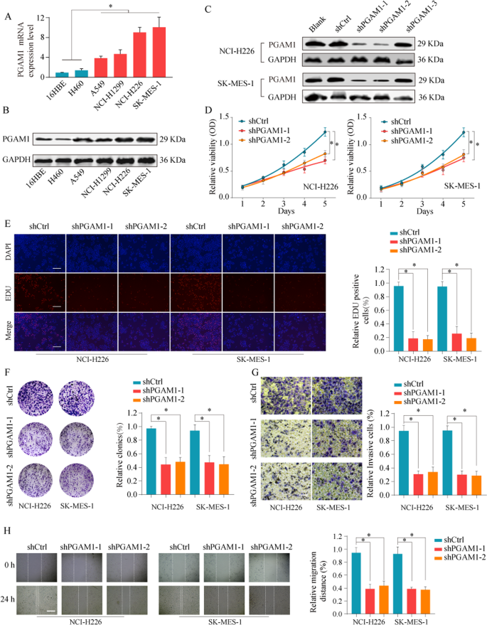 Fig. 3: PGAM1 knockdown inhibit NSCLC cell proliferation and invasion.