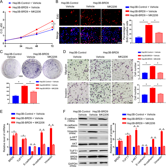 Fig. 8: An AKT inhibitor abrogates the promoting effects of BRD9 on Hep3B cell growth and metastasis.