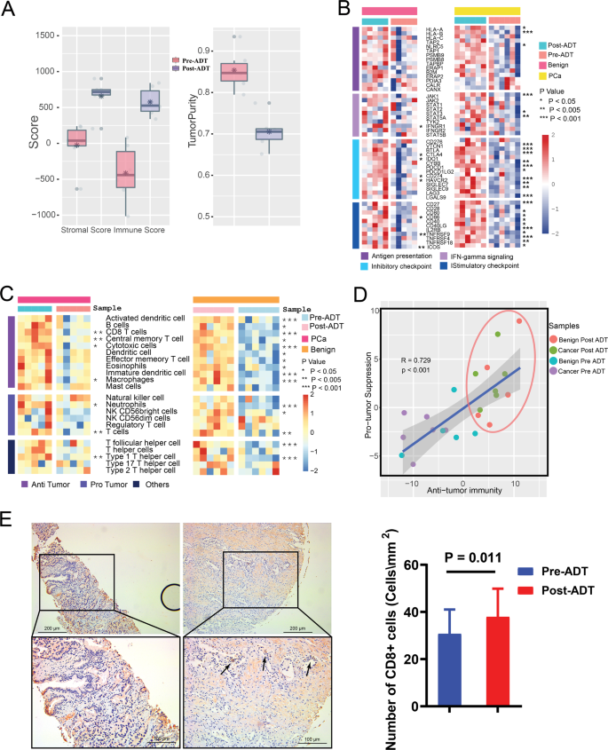 Fig. 2: ADT remodel PCa TIM.