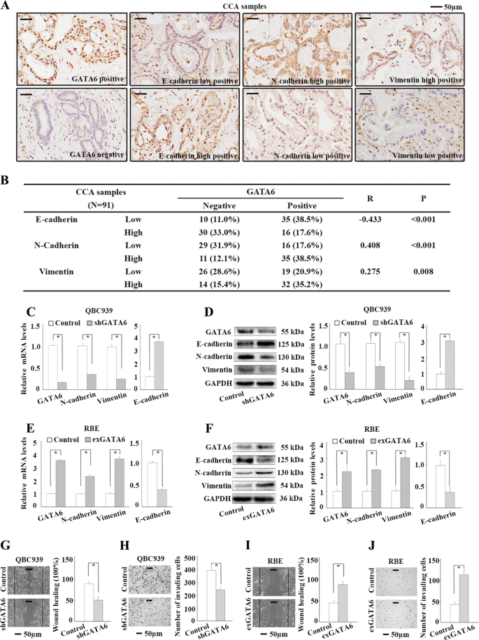 Gata6 Promotes Epithelial Mesenchymal Transition And Metastasis Through Muc1 B Catenin Pathway In Cholangiocarcinoma Cell Death Disease