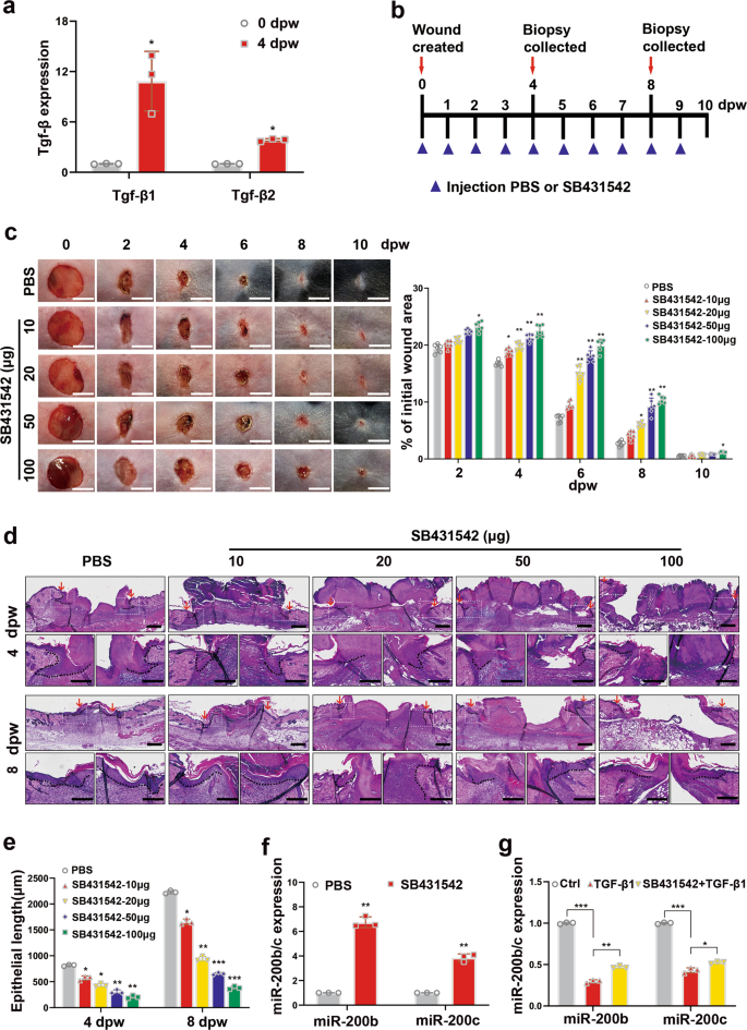 Microrna 0b C 3p Regulate Epithelial Plasticity And Inhibit Cutaneous Wound Healing By Modulating Tgf B Mediated Rac1 Signaling Cell Death Disease