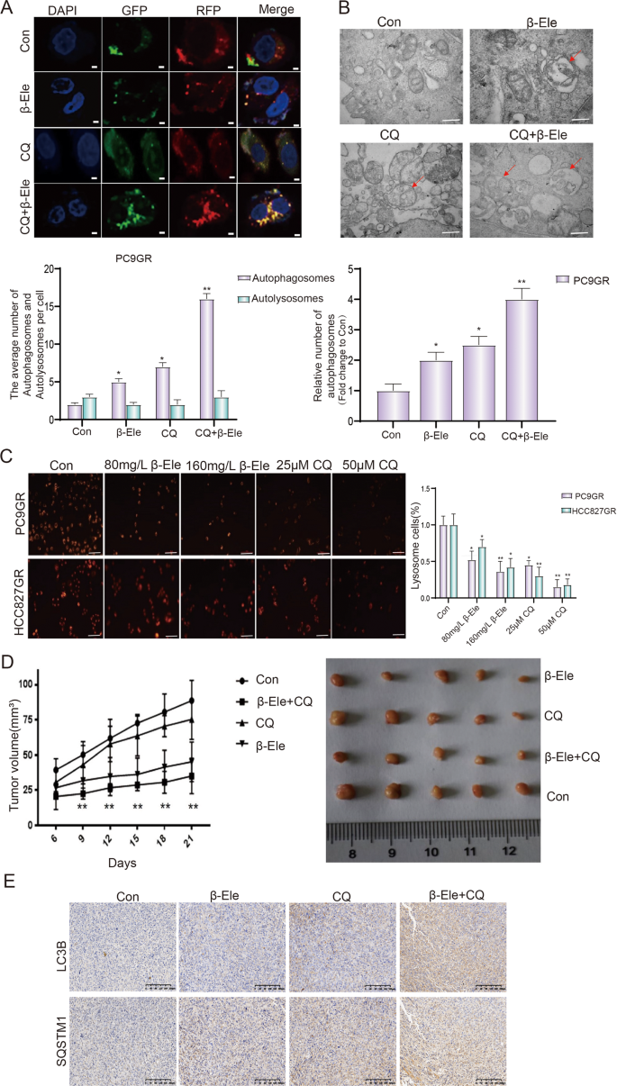 Fig. 4: β-elemene blocked autophagy flux in NSCLC cells.