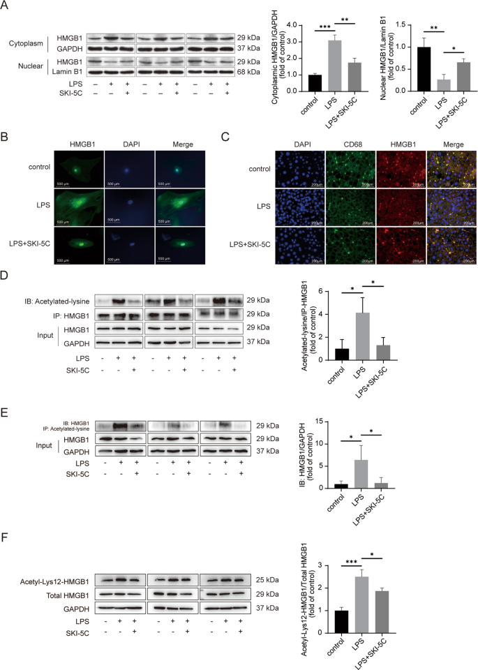 Fig. 2: HMGB1 intracellular translocation and acetylation can be suppressed by SphK1 inhibition.