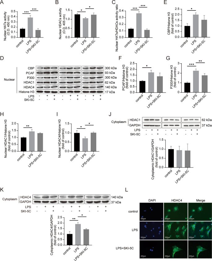 Fig. 3: SphK1 inhibition suppresses p300 expression and HDAC4 translocation.
