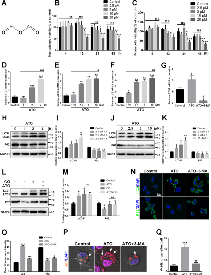 Fig. 1: ATO induces autophagy in macrophages.