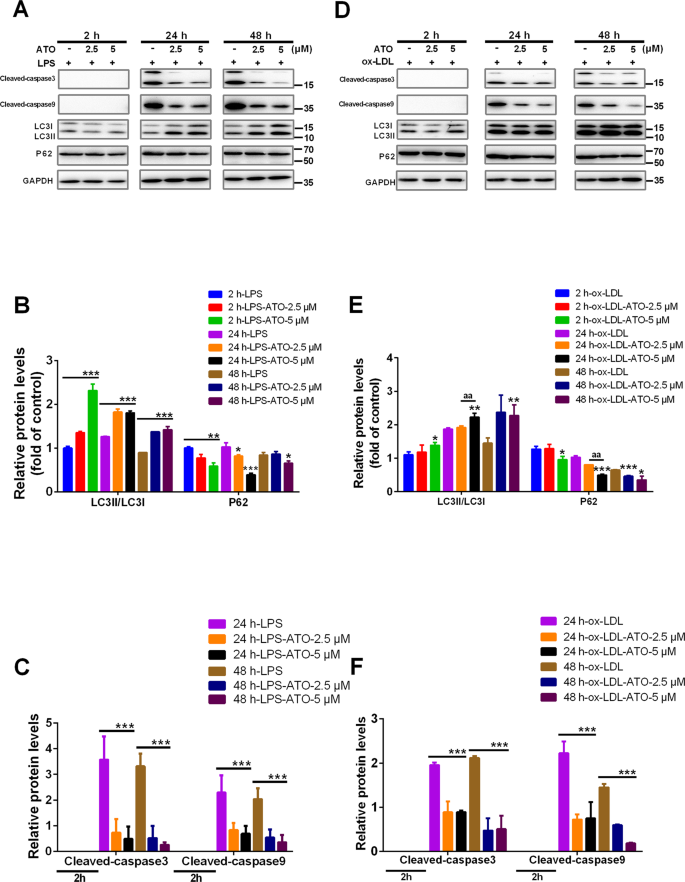 Fig. 2: ATO induce autophagy earlier than inhibiting the expression of apoptosis markers in macrophages and foam cells.