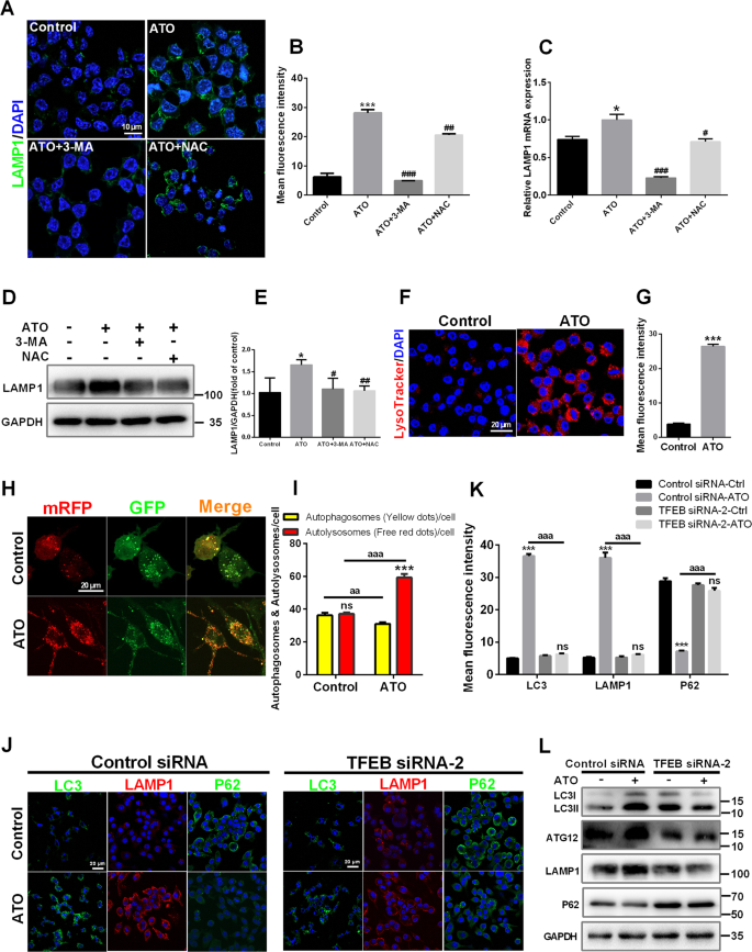 Fig. 5: ATO promotes TFEB-dependent lysosome biosynthesis and the fusion between autophagosomes and lysosomes in macrophages.