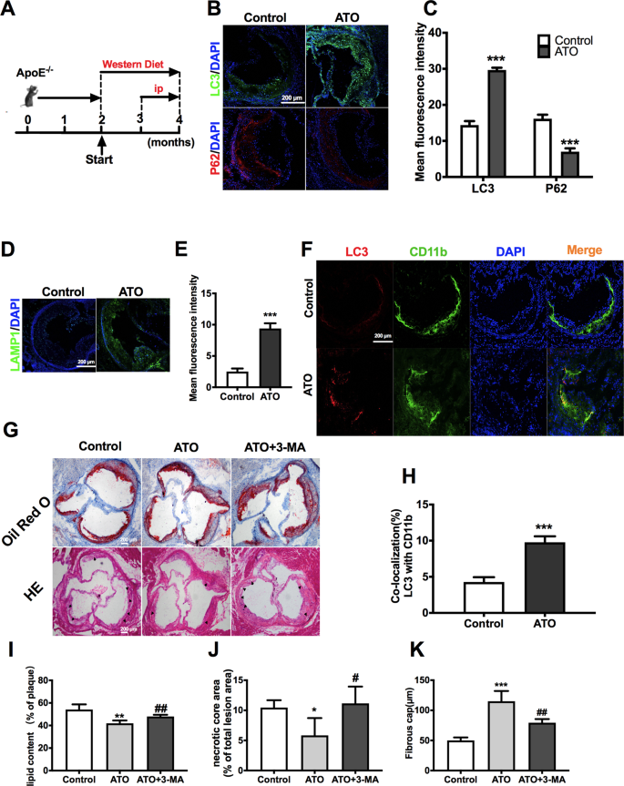 Fig. 7: ATO administration accelerates autophagy in the aorta of ApoE−/− mice and reduces atherosclerotic lesion.
