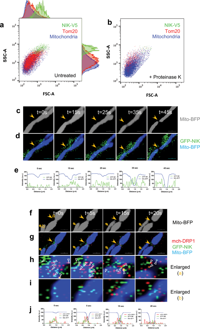 NIK promotes metabolic adaptation of glioblastoma cells to bioenergetic  stress | Cell Death & Disease