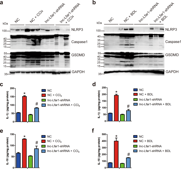Fig. 3: Silencing lnc-Lfar1 ameliorates CCl4- and BDL-induced NLRP3 inflammasome-mediated pyroptosis.
