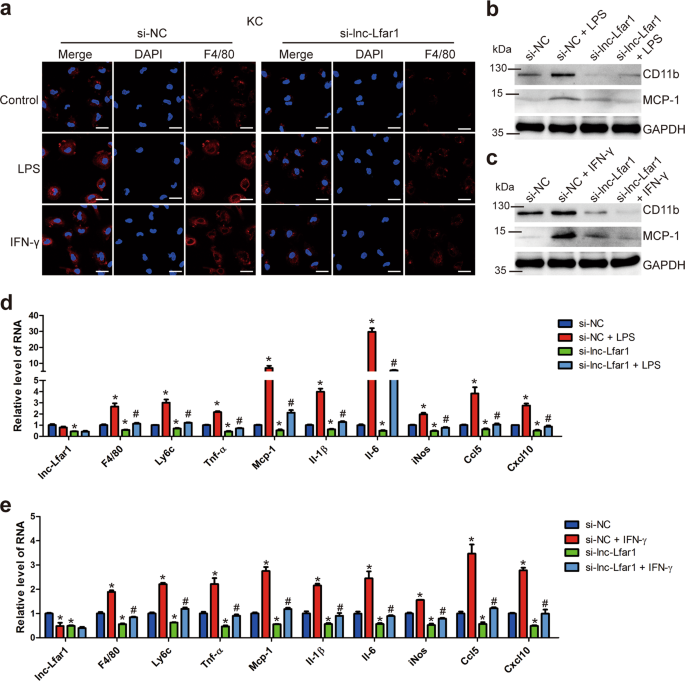 Fig. 4: Lnc-Lfar1 knockdown suppresses LPS- and IFN-γ-induced proinflammatory activation of macrophages.