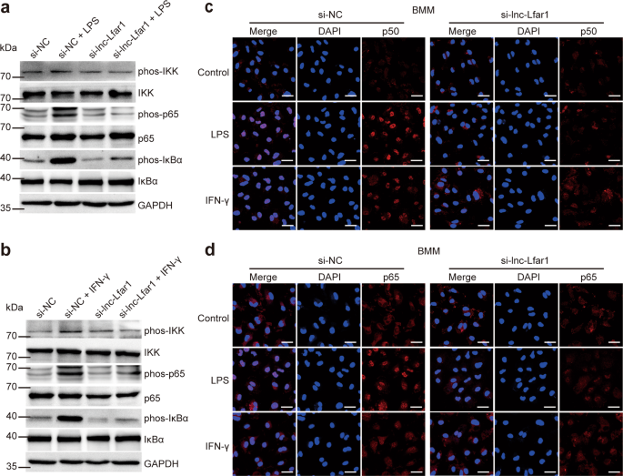 Fig. 6: lnc-Lfar1 regulates macrophages activation through the NF-ĸB pathway.