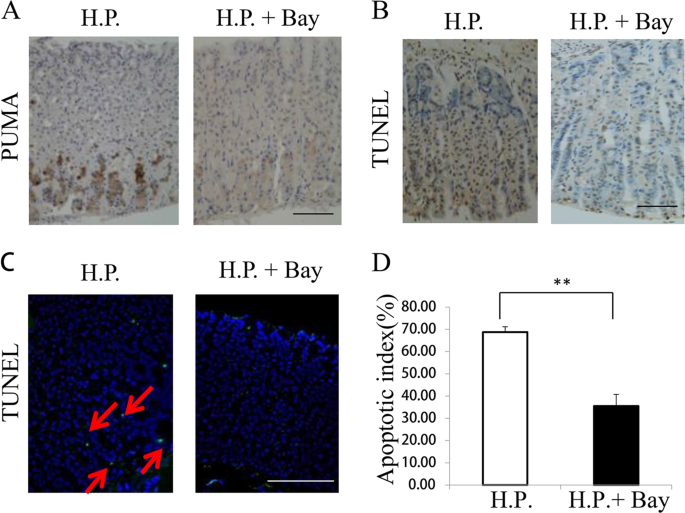 PUMA-mediated epithelial cell apoptosis promotes Helicobacter pylori  infection-mediated gastritis | Cell Death & Disease