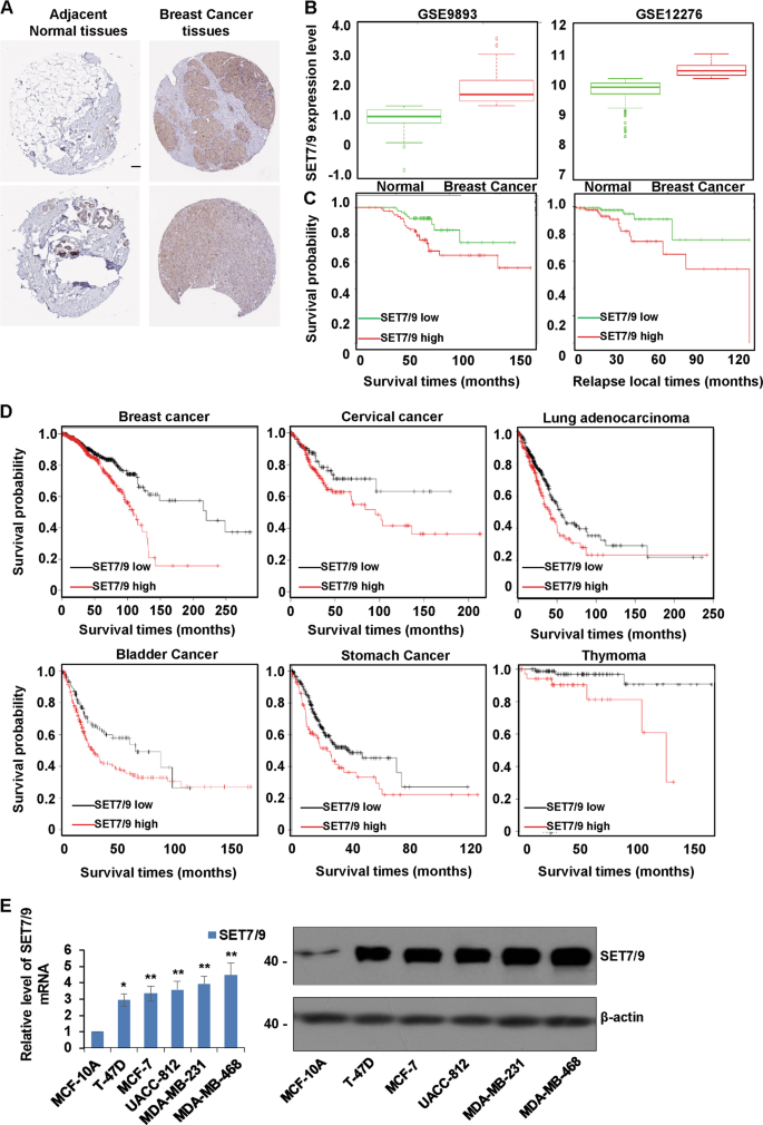 Fig. 1: SET7/9 is upregulated in breast cancer tissues and predicts a worse prognosis.
