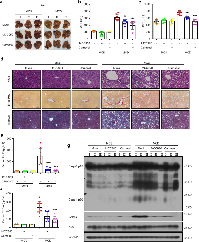 Fig. 6: Carnosol suppresses liver injury and fibrosis in an experimental NASH model.