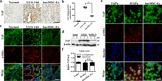 Fig. 3: HucMSC-Ex attenuated tubulointerstitial fibrosis by inhibited YAP.