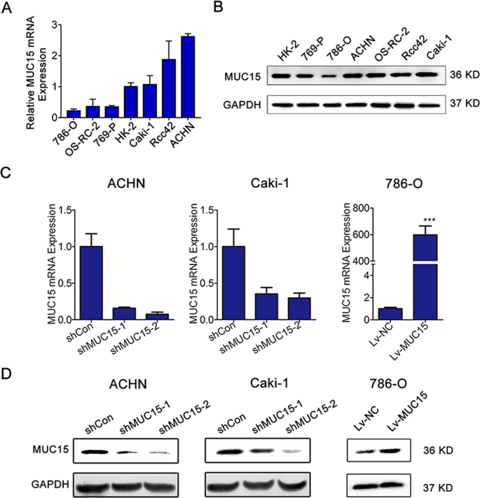 Fig. 2: Expression of MUC15 in RCC cell lines and establishment of sublines.