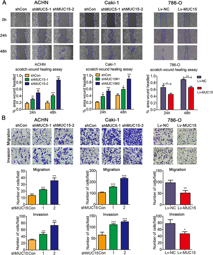 Fig. 3: Effects of MUC15 in cell migration and invasion of RCC cell lines.