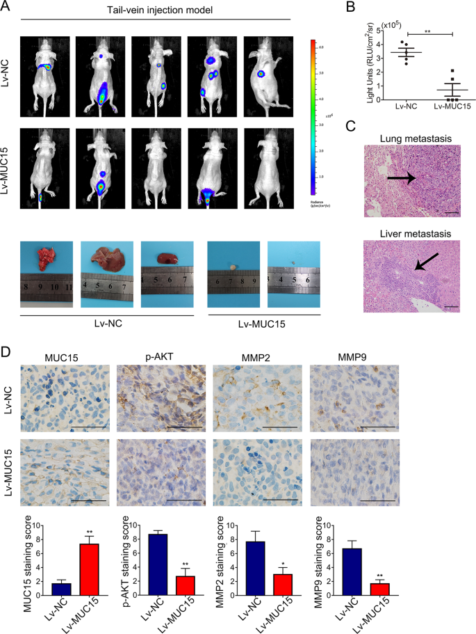 Fig. 6: MUC15 modulated RCC cells distant metastasis in vivo.