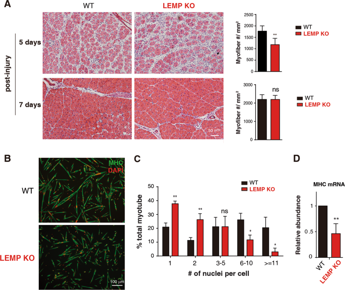 Fig. 4: LEMP promotes skeletal muscle regeneration and activates satellite cell differentiation.