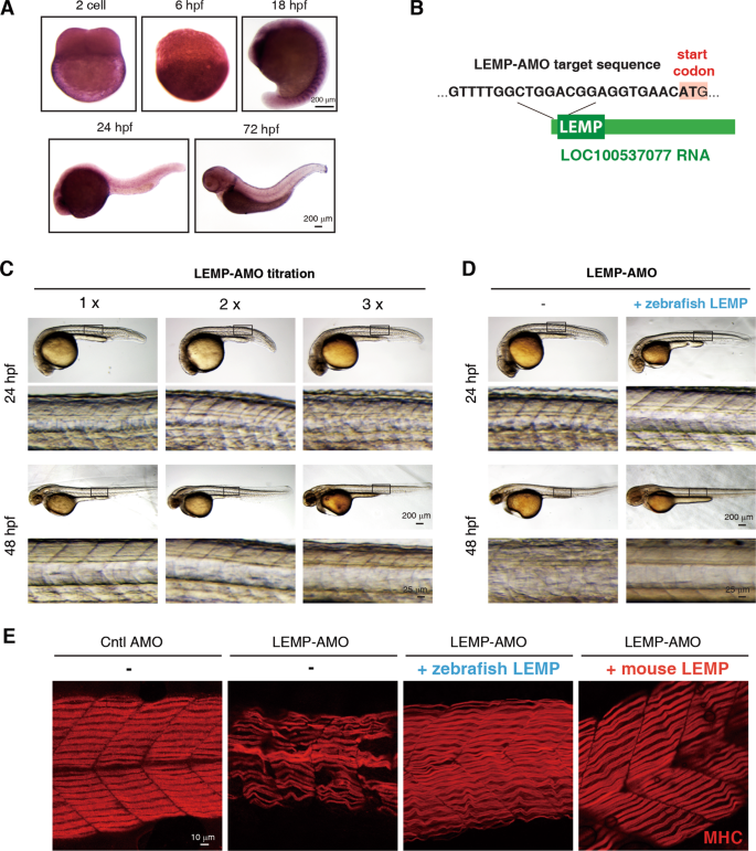 Fig. 5: LEMP is important for muscle development in zebrafish.
