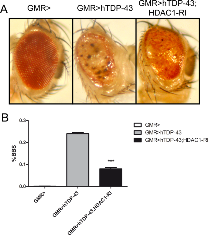 Hdac1 Inhibition Ameliorates Tdp 43 Induced Cell Death In Vitro And In Vivo Cell Death Disease