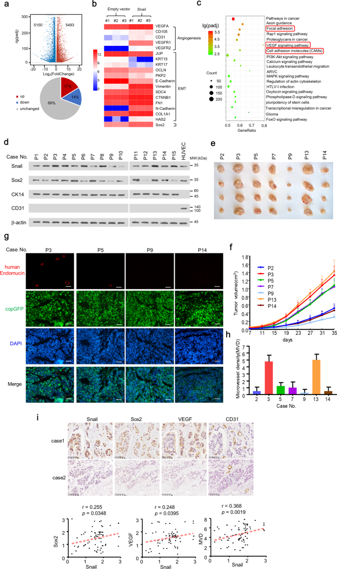 Fig. 1: Snail is associated with the angiogenesis pathway and enhances vascular endothelium generation of breast cancer patient-derived cells in vivo.