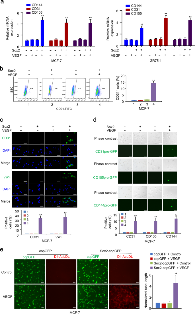 Fig. 4: Sox2 alone fails to induce endothelium generation in breast cancer cells.