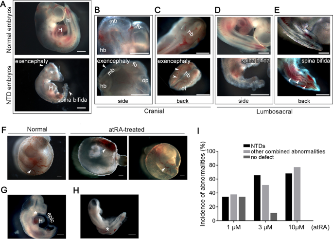 Fig. 1: atRA induces NTDs in rat embryos ex vivo.