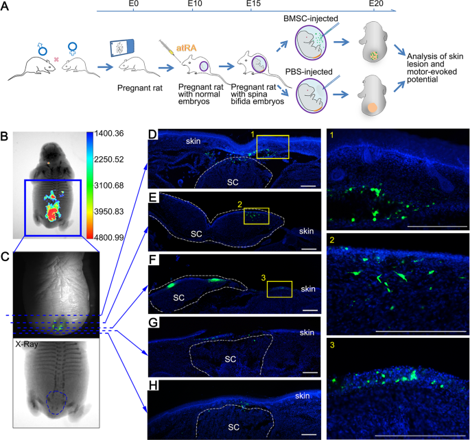 Fig. 5: Transplanted BMSCs engrafted in different tissues of the lesion.