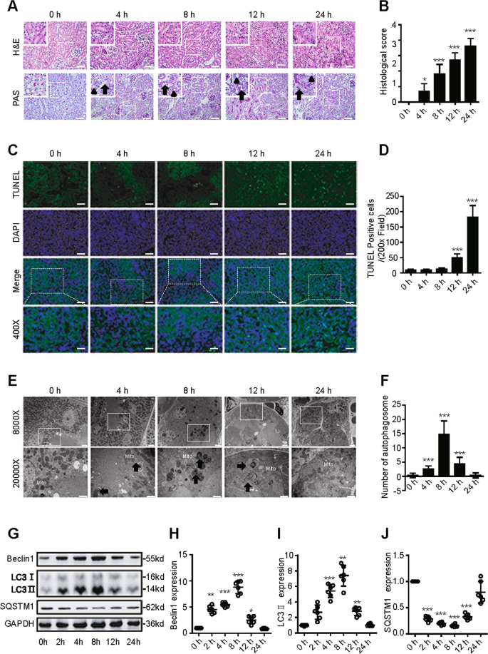 Fig. 1: Dynamic changes in autophagy in an animal model of SAKI.
