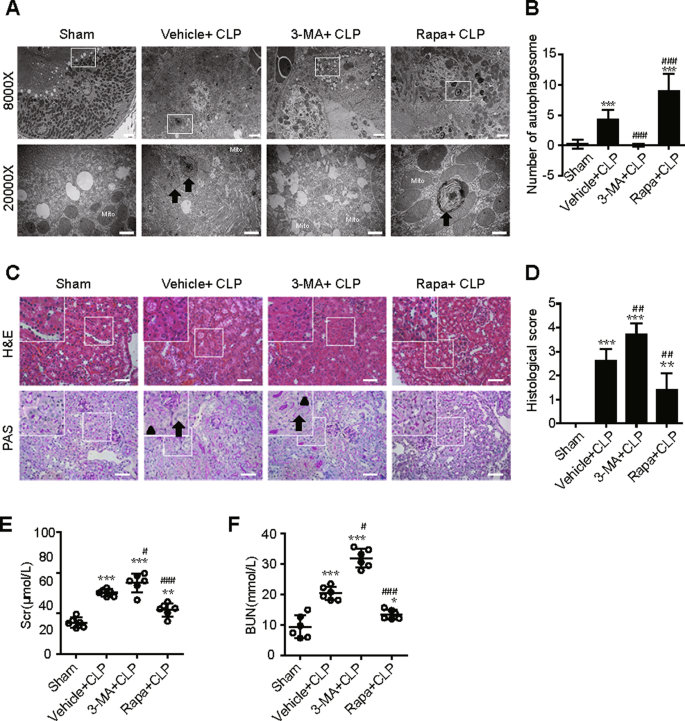 Fig. 2: Activation of autophagy protects against SAKI in RTECs.