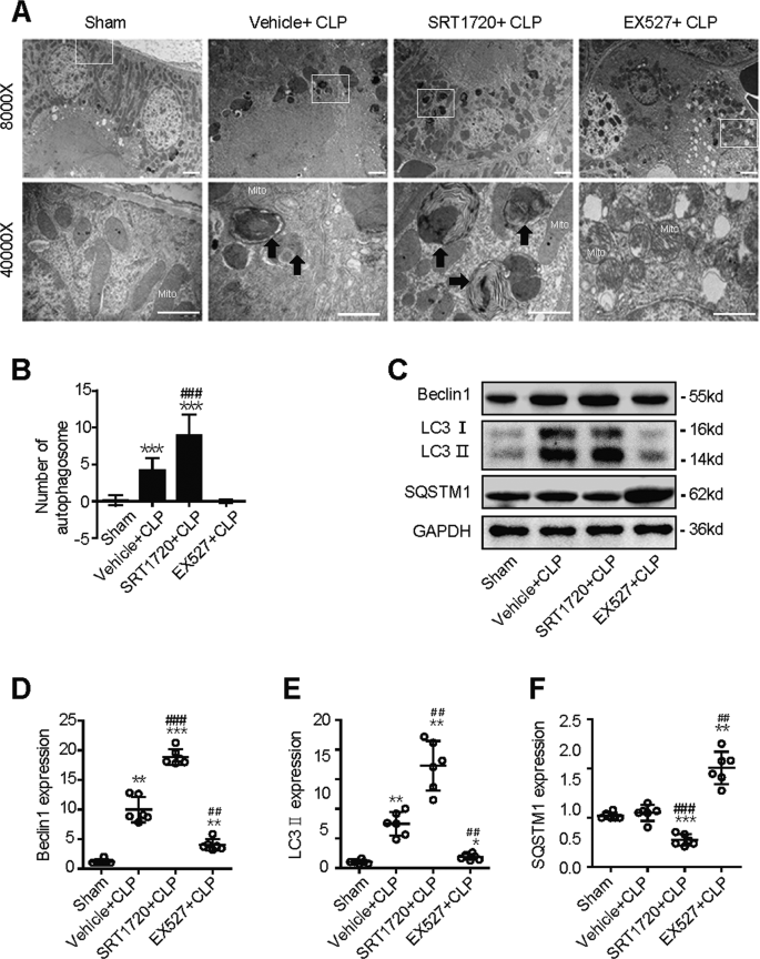 Fig. 3: SIRT1 attenuates SAKI by promoting autophagy.