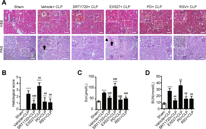 Fig. 7: SIRT1 activation attenuates SAKI.