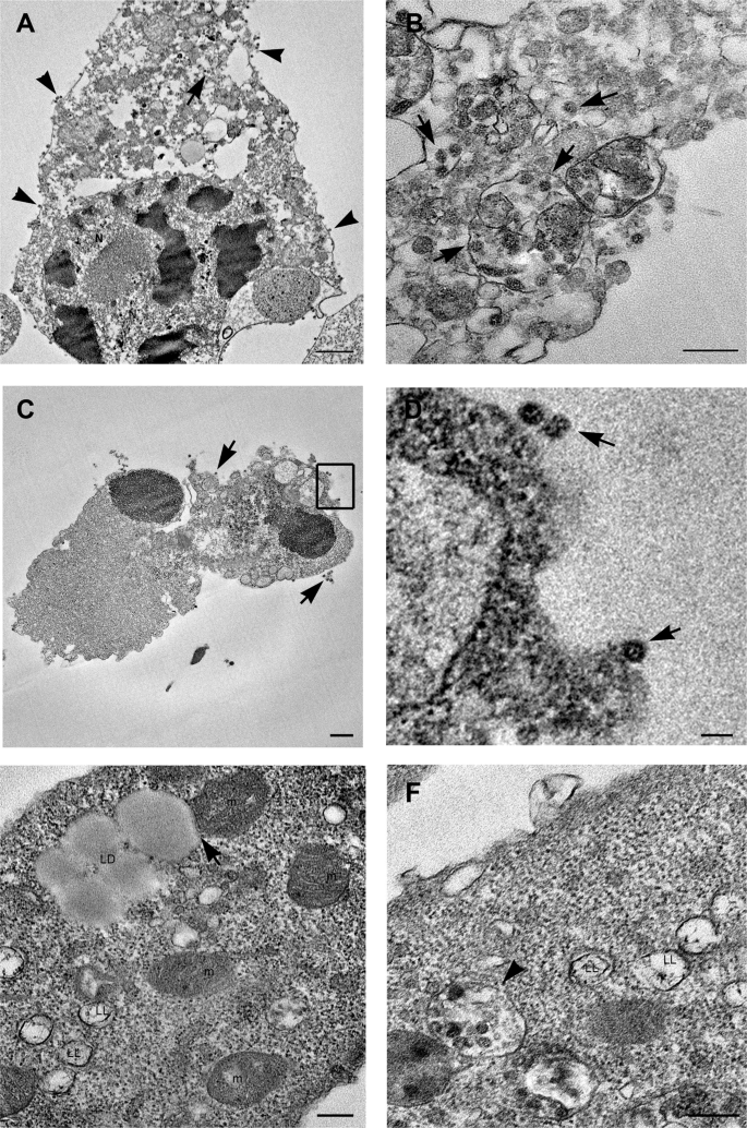 Fig. 2: Electron microscopy features of SARS-CoV-2-infected dying cells.